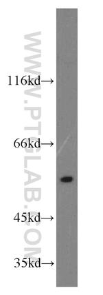 RHCG Antibody in Western Blot (WB)