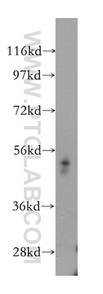 RHCG Antibody in Western Blot (WB)