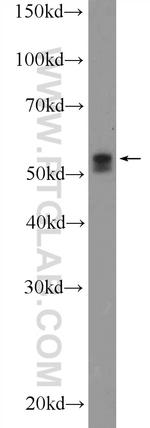 TRIM6 Antibody in Western Blot (WB)