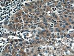 DNAJC2/MPP11 Antibody in Immunohistochemistry (Paraffin) (IHC (P))