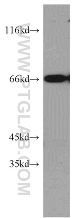 DNAJC2/MPP11 Antibody in Western Blot (WB)