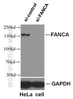 FANCA Antibody in Western Blot (WB)