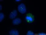 MLK3 Antibody in Immunocytochemistry (ICC/IF)