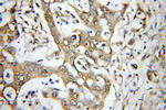 MLK3 Antibody in Immunohistochemistry (Paraffin) (IHC (P))