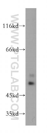 OLFM2 Antibody in Western Blot (WB)