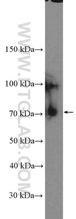 TrkC Antibody in Western Blot (WB)