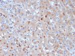 Alpha-1-Antichymotrypsin (SERPINA3) (Histiocytoma Marker) Antibody in Immunohistochemistry (Paraffin) (IHC (P))