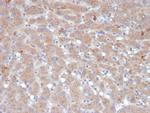 Alpha-1-Antichymotrypsin (SERPINA3) (Histiocytoma Marker) Antibody in Immunohistochemistry (Paraffin) (IHC (P))