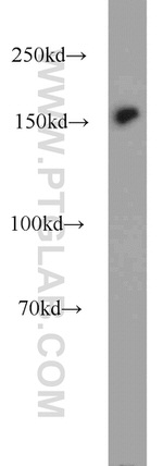 BAF170 Antibody in Western Blot (WB)