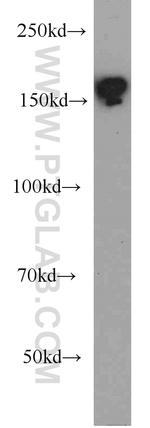 BAF170 Antibody in Western Blot (WB)