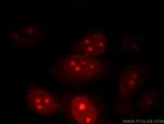 POP1 Antibody in Immunocytochemistry (ICC/IF)