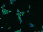 STT3A Antibody in Immunocytochemistry (ICC/IF)