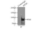 KIF2C Antibody in Immunoprecipitation (IP)