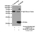 RAB39B Antibody in Immunoprecipitation (IP)