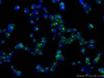 GOPC Antibody in Immunocytochemistry (ICC/IF)