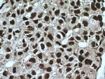 FAM107A Antibody in Immunohistochemistry (Paraffin) (IHC (P))