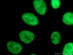SMNDC1 Antibody in Immunocytochemistry (ICC/IF)