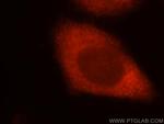 TOMM34 Antibody in Immunocytochemistry (ICC/IF)