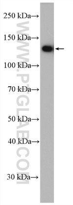 USP25 Antibody in Western Blot (WB)