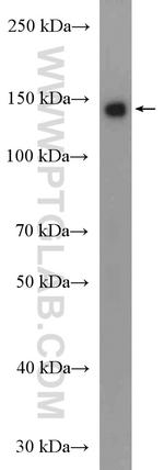 USP25 Antibody in Western Blot (WB)