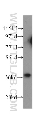 Cathepsin B Antibody in Western Blot (WB)