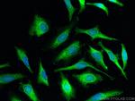 Calpastatin Antibody in Immunocytochemistry (ICC/IF)