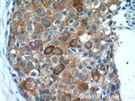 Calpastatin Antibody in Immunohistochemistry (Paraffin) (IHC (P))