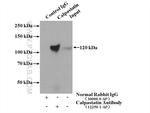 Calpastatin Antibody in Immunoprecipitation (IP)