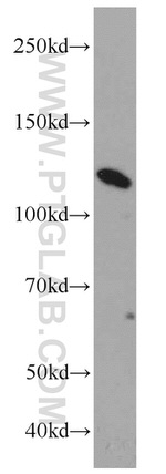 Calpastatin Antibody in Western Blot (WB)