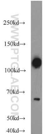 Calpastatin Antibody in Western Blot (WB)