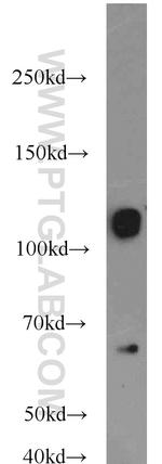 Calpastatin Antibody in Western Blot (WB)