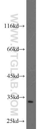 SLC25A11 Antibody in Western Blot (WB)