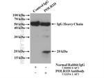 POLR1D Antibody in Immunoprecipitation (IP)