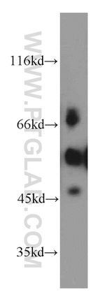 ETS2 Antibody in Western Blot (WB)