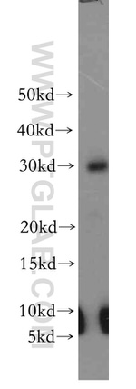 TSPAN6 Antibody in Western Blot (WB)