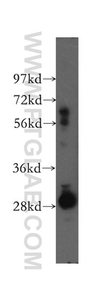SFXN1 Antibody in Western Blot (WB)