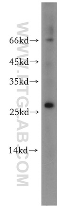 Neurotrophin 4 Antibody in Western Blot (WB)