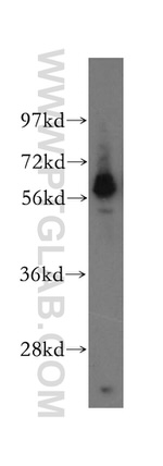 MTMR8 Antibody in Western Blot (WB)