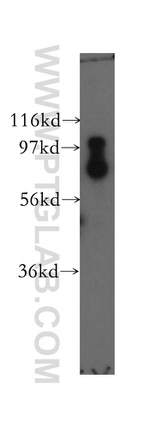 SCYL2 Antibody in Western Blot (WB)