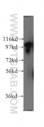 SCYL2 Antibody in Western Blot (WB)