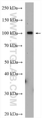 SCYL2 Antibody in Western Blot (WB)