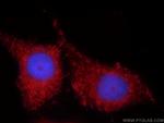 TIMP-4 Antibody in Immunocytochemistry (ICC/IF)