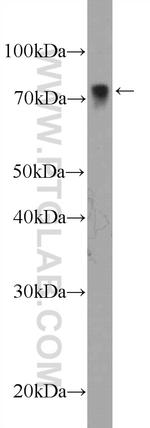 LIMK2 Antibody in Western Blot (WB)