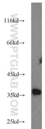 IL33 Antibody in Western Blot (WB)