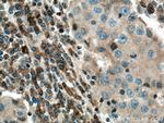 COX2 Antibody in Immunohistochemistry (Paraffin) (IHC (P))