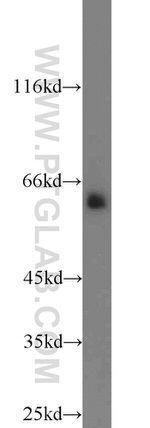 COX2 Antibody in Western Blot (WB)