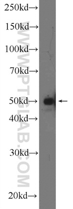 A4GALT Antibody in Western Blot (WB)