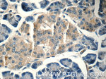 HOMER1 Antibody in Immunohistochemistry (Paraffin) (IHC (P))