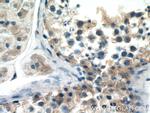 STAM Antibody in Immunohistochemistry (Paraffin) (IHC (P))