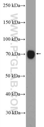 STAM Antibody in Western Blot (WB)